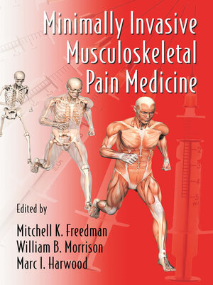 cover image of Minimally Invasive Musculoskeletal Pain Medicine